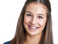 Apeleaza acum la specialistii in ortodontie de la Dr Leahu